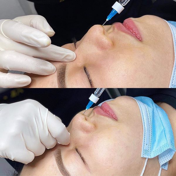 Thẩm mỹ Phương Tây Beauty cam kết độ chuyên nghiệp 100%